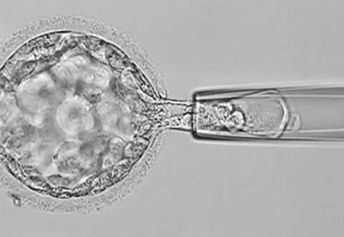 Så här görs biopsin: Som du ser tas ett litet cellprov från den yttre cellmassan – den framtida placentan. Ingen biopsi tas från den inre cellmassan – den framtida embryokroppen.
